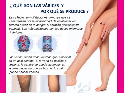 INYECCIÓN DE VARICES EN SOYAPANGO